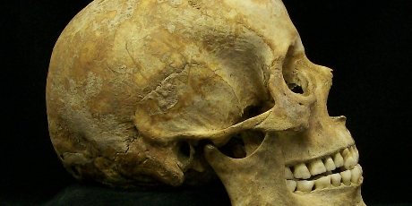 Cranio in norma laterale destra. Da contesto archeologico, tardo-romano